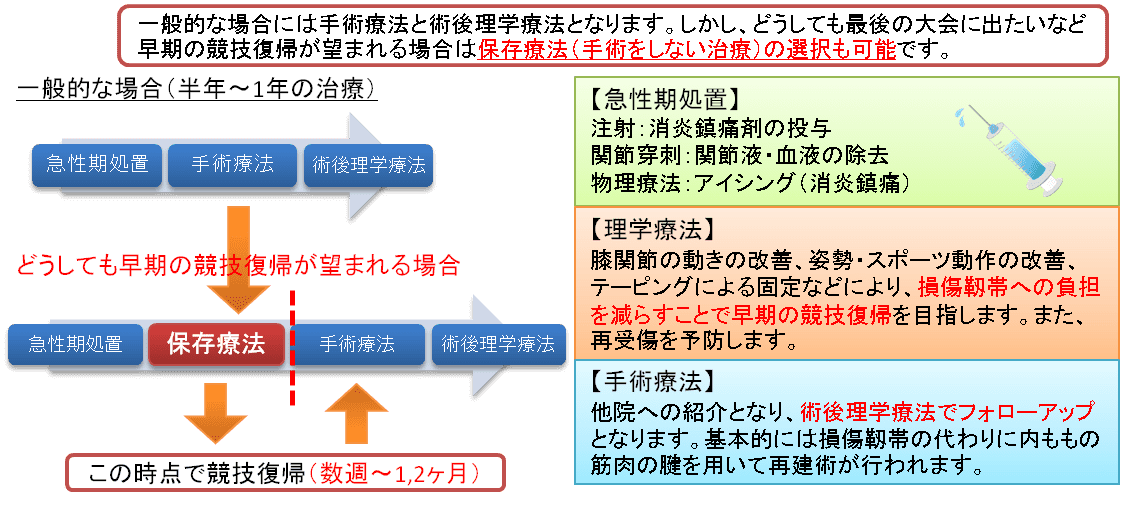 前十字靭帯損傷の治療